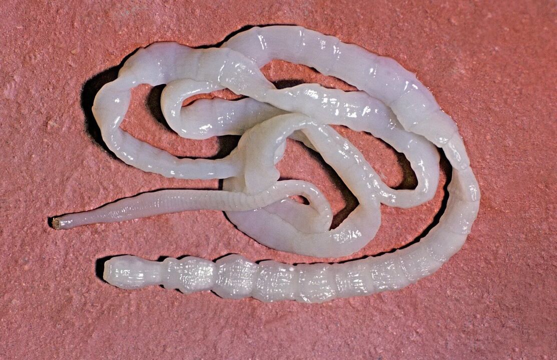 Bovine tapeworm in humans